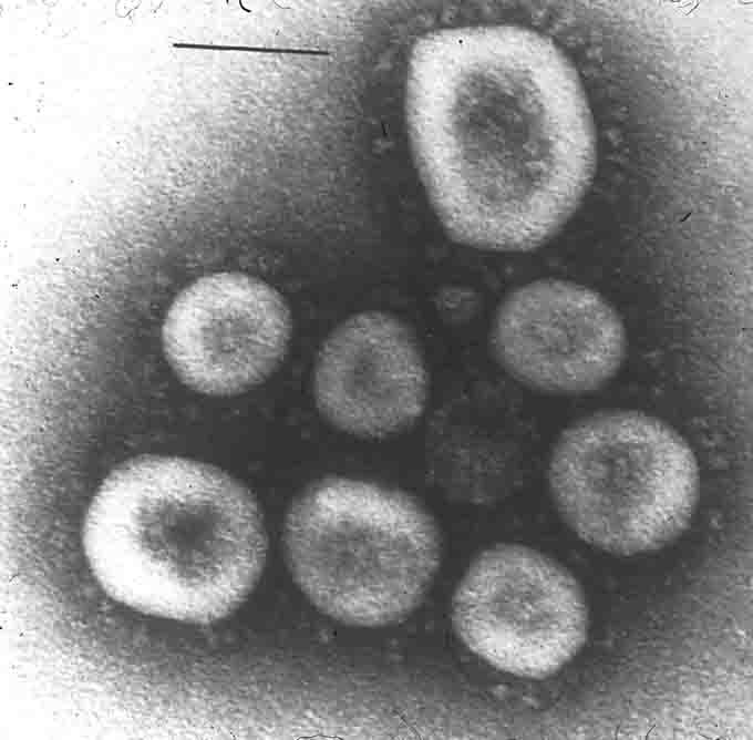 اولین تصویر از ویروس کرونا